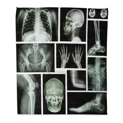 X-Ray Anatomy Collage Blanket: Skeletal X-Ray Print