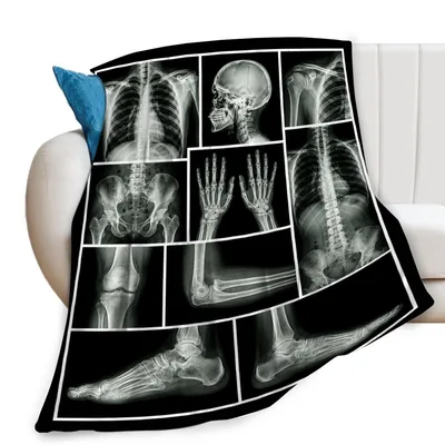 X-ray Skeleton Anatomy Blanket: Medical Print for Healthcare Workers